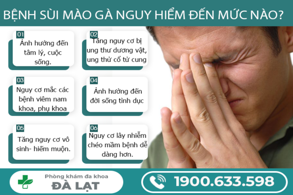 Hình ảnh minh họa